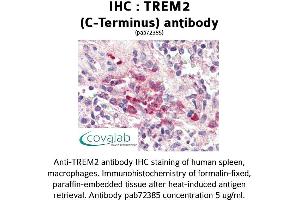 Image no. 1 for anti-Triggering Receptor Expressed On Myeloid Cells 2 (TREM2) (C-Term) antibody (ABIN1740338) (TREM2 antibody  (C-Term))