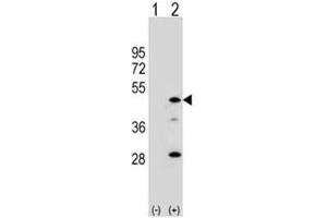 Western blot analysis of AADAC antibody and 293 cell lysate either nontransfected (Lane 1) or transiently transfected (2) with the AADAC gene. (AADAC antibody  (AA 273-300))