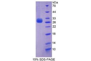 SDS-PAGE (SDS) image for Perforin 1 (Pore Forming Protein) (PRF1) (AA 120-353) protein (His tag) (ABIN2126259)