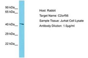 Image no. 1 for anti-NADH Dehydrogenase (Ubiquinone) Complex I, Assembly Factor 7 (NDUFAF7) (C-Term) antibody (ABIN6750633) (NDUFAF7 antibody  (C-Term))