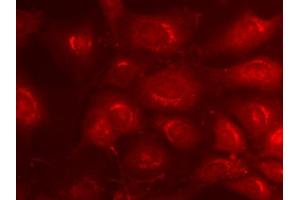 Indirect immunofluorescence on 3T3 cells (dilution 1 : 500) in combination with a Cy3 labeled secondary antibody (dilution 1 : 500). (Syntaxin 6 antibody  (AA 1-235))
