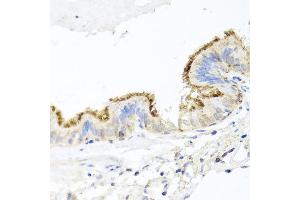 Immunohistochemistry of paraffin-embedded human trachea using CD44 antibody at dilution of 1:100 (x40 lens). (CD44 antibody)