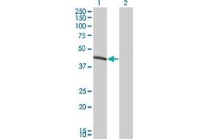 Western Blot analysis of BCS1L expression in transfected 293T cell line by BCS1L monoclonal antibody (M01), clone 5F3. (BCS1L antibody  (AA 320-418))