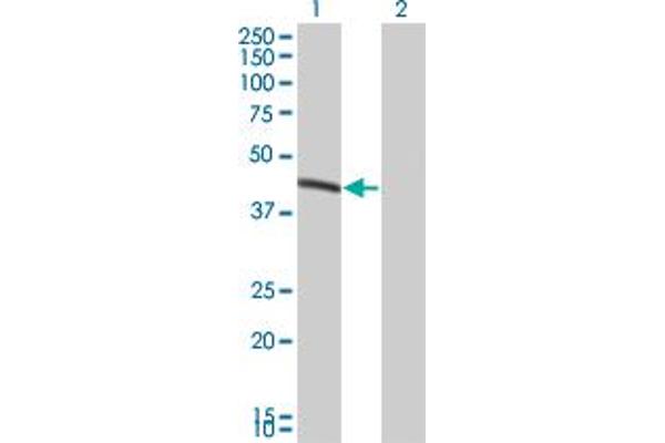 BCS1L antibody  (AA 320-418)