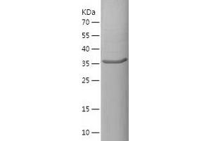 Western Blotting (WB) image for Thyroglobulin (TG) (AA 2253-2420) protein (His-IF2DI Tag) (ABIN7283584) (Thyroglobulin Protein (TG) (AA 2253-2420) (His-IF2DI Tag))