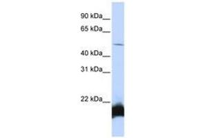 Image no. 1 for anti-One Cut Homeobox 1 (ONECUT1) (N-Term) antibody (ABIN6740547) (ONECUT1 antibody  (N-Term))