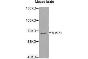 Western blot analysis of extracts of mouse brain, using MMP9 antibody (ABIN4904400) at 1:1000 dilution.