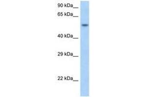Image no. 1 for anti-Small Nuclear RNA Activating Complex, Polypeptide 1, 43kDa (SNAPC1) (N-Term) antibody (ABIN6748076) (SNAPC1 antibody  (N-Term))