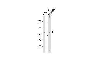 All lanes : Anti-GBA2 Antibody (Center) at 1:2000 dilution Lane 1: human brain lysate Lane 2: mouse brain lysate Lysates/proteins at 20 μg per lane. (GBA2 antibody  (AA 593-623))