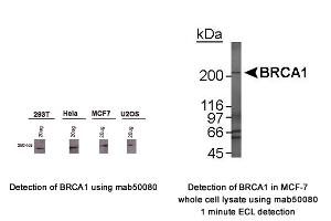 Image no. 1 for anti-Breast Cancer 1 (BRCA1) (AA 1314-1600), (AA 1314-1864) antibody (ABIN363234) (BRCA1 antibody  (AA 1314-1600, AA 1314-1864))