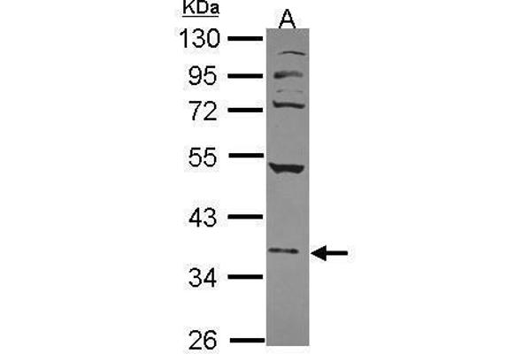 NFE2 antibody  (Center)