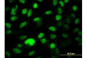 Immunofluorescence of monoclonal antibody to PPP1R8 on HeLa cell. (PPP1R8 antibody  (AA 1-209))