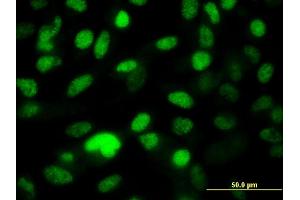 Immunofluorescence of monoclonal antibody to PPP1R8 on HeLa cell. (PPP1R8 antibody  (AA 1-209))