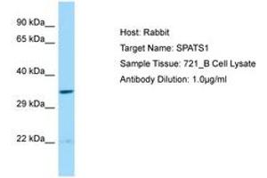 Image no. 1 for anti-Spermatogenesis Associated, Serine-Rich 1 (SPATS1) (AA 21-70) antibody (ABIN6750229) (SPATS1 antibody  (AA 21-70))