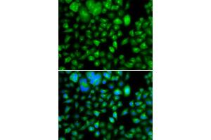 Immunofluorescence analysis of A549 cells using METTL7B antibody (ABIN5974333). (METTL7B antibody)