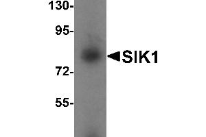 Western blot analysis of SIK1 in human small intestine tissue lysate with SIK1 antibody at 1 µg/mL. (SIK1 antibody  (Middle Region))