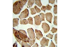 Formalin-fixed and paraffin-embedded human skeletal muscle reacted with Denatured ATG1 Antibody , which was peroxidase-conjugated to the secondary antibody, followed by DAB staining. (ULK1 antibody)