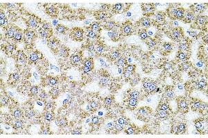 Immunohistochemistry of paraffin-embedded Rat liver using ALDH1A1 Polyclonal Antibody at dilution of 1:100 (40x lens). (ALDH1A1 antibody)