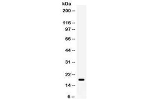 Western blot testing of human MCF7 cell lysate with GADD45A antibody. (GADD45A antibody)
