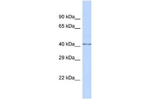 Host:  Rabbit  Target Name:  FKTN  Sample Type:  Fetal Brain lysates  Antibody Dilution:  1.