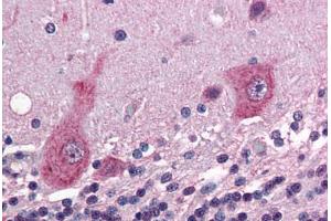 Human Brain, Cerebellum (formalin-fixed, paraffin-embedded) stained with GRIK5 antibody ABIN343908 at 5 ug/ml followed by biotinylated goat anti-rabbit IgG secondary antibody ABIN481713, alkaline phosphatase-streptavidin and chromogen. (GRIK5 antibody  (C-Term))