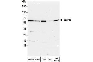 Western Blotting (WB) image for anti-Glucose-6-Phosphate Dehydrogenase (G6PD) (AA 50-100) antibody (ABIN7449226) (Glucose-6-Phosphate Dehydrogenase antibody  (AA 50-100))
