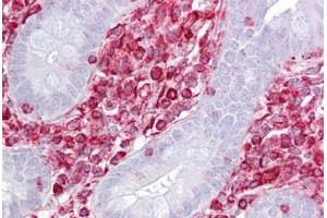 Anti-RACK1 antibody IHC staining of human small intestine. (GNB2L1 antibody  (AA 71-120))