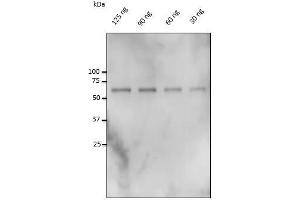 Anti-Catalase Ab at 1/500 dilution, 30-125 ng of catalase isolated from bovine liver, rabbit polyclonal to goat IgG (HRP) at 1/10,000 dilution, (Catalase antibody)