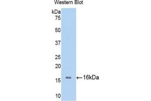 Detection of Recombinant FGFR1, Human using Polyclonal Antibody to Fibroblast Growth Factor Receptor 1 (FGFR1) (FGFR1 antibody  (AA 236-362))