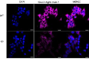 Immunocytochemical staining of Hela cells using Kinesin light chain 1 antibody (ABIN7799210), 1:1,000), Top panel: wild-type (WT), Bottom panal: Kinesin light chain 1 shRNA knockdown (KD). (Recombinant KLC1 antibody)