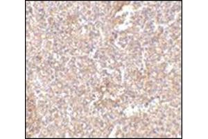 Immunohistochemistry of STEAP1 in human spleen tissue with this product at 2. (STEAP1 antibody  (Center))