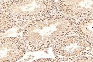 Immunohistochemistry analysis of paraffin-embedded rat testis using,MCM4 (ABIN7074631) at dilution of 1: 2400 (MCM4 antibody)