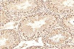Immunohistochemistry analysis of paraffin-embedded rat testis using,MCM4 (ABIN7074631) at dilution of 1: 2400