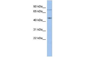 WB Suggested Anti-ZNF195 Antibody Titration:  0.