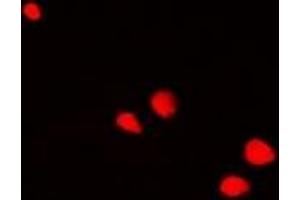 Immunofluorescent analysis of POLR2D staining in SW620 cells. (POLR2D antibody)