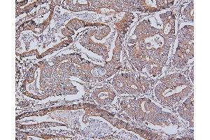 IHC analysis of DDR1 using anti-DDR1 antibody (ABIN7601407). (DDR1 antibody  (AA 341-909))
