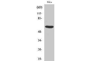 Western Blotting (WB) image for anti-PHD Finger Protein 1 (PHF1) (Internal Region) antibody (ABIN3186420)