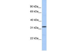 WB Suggested Anti-SPRY3 Antibody Titration:  0.