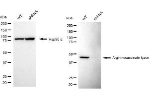 anti-Argininosuccinate Lyase (ASL) antibody