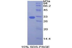 SDS-PAGE (SDS) image for Dedicator of Cytokinesis 1 (DOCK1) (AA 1200-1435) protein (His tag) (ABIN2124600)