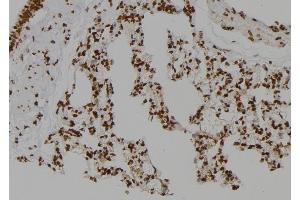 ABIN6276767 at 1/100 staining Rat lung tissue by IHC-P. (CSNK2A2 antibody  (N-Term))