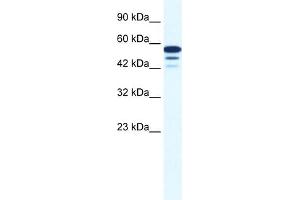 WB Suggested Anti-ZNF230 Antibody Titration:  0. (ZNF230 antibody  (N-Term))