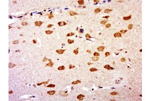 anti-Guanine Nucleotide Binding Protein (G Protein), beta 5 (GNB5) (AA 51-150) antibody