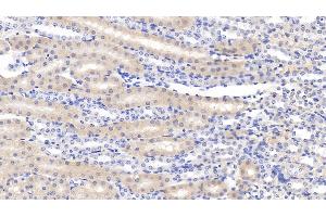 Detection of CLIC4 in Mouse Kidney Tissue using Polyclonal Antibody to Chloride Intracellular Channel Protein 4 (CLIC4) (CLIC4 antibody  (AA 104-253))