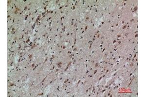 Immunohistochemical analysis of paraffin-embedded human-brain, antibody was diluted at 1:100. (CD58 antibody  (Internal Region))