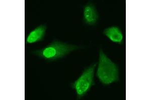 IF analysis of ADK using anti-ADK antibody (ABIN4886430). (ADK antibody  (AA 165-351))