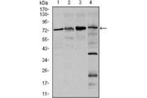 Western Blotting (WB) image for anti-Forkhead Box O1 (FOXO1) antibody (ABIN1107270) (FOXO1 antibody)