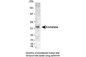 Image no. 1 for anti-Cytochrome P450, Family 19, Subfamily A, Polypeptide 1 (CYP19A1) (C-Term) antibody (ABIN363492) (Aromatase antibody  (C-Term))