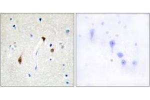 Immunohistochemistry analysis of paraffin-embedded human brain tissue, using HAIR Antibody. (Hairless antibody  (AA 41-90))
