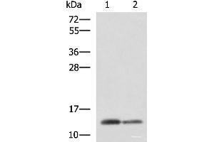 Western blot analysis of Human breast tissue and Human thyroid tissue lysates using CRABP1 Polyclonal Antibody at dilution of 1:2000 (CRABP1 antibody)